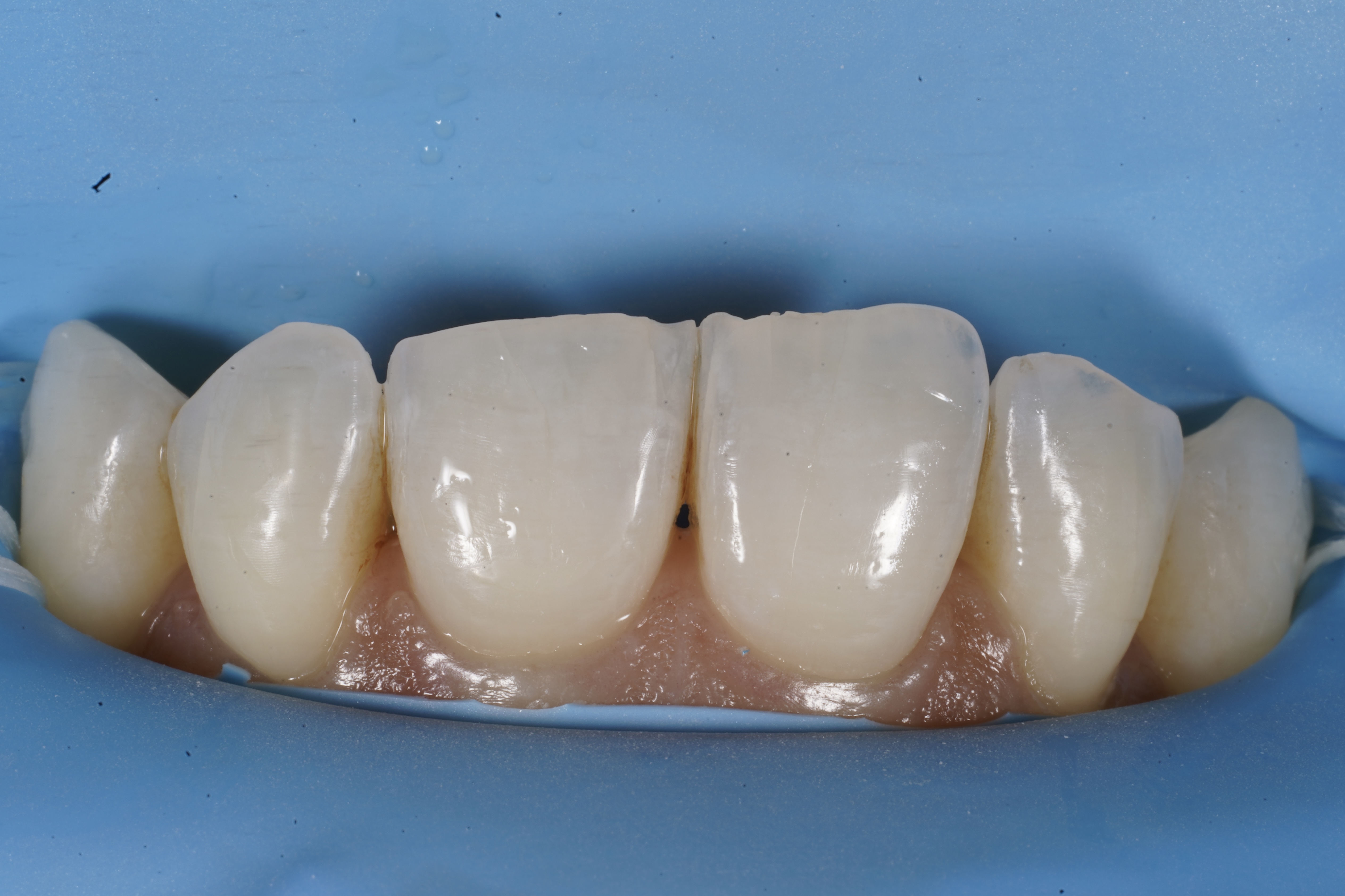 Composite bonding isolation with rubber dam