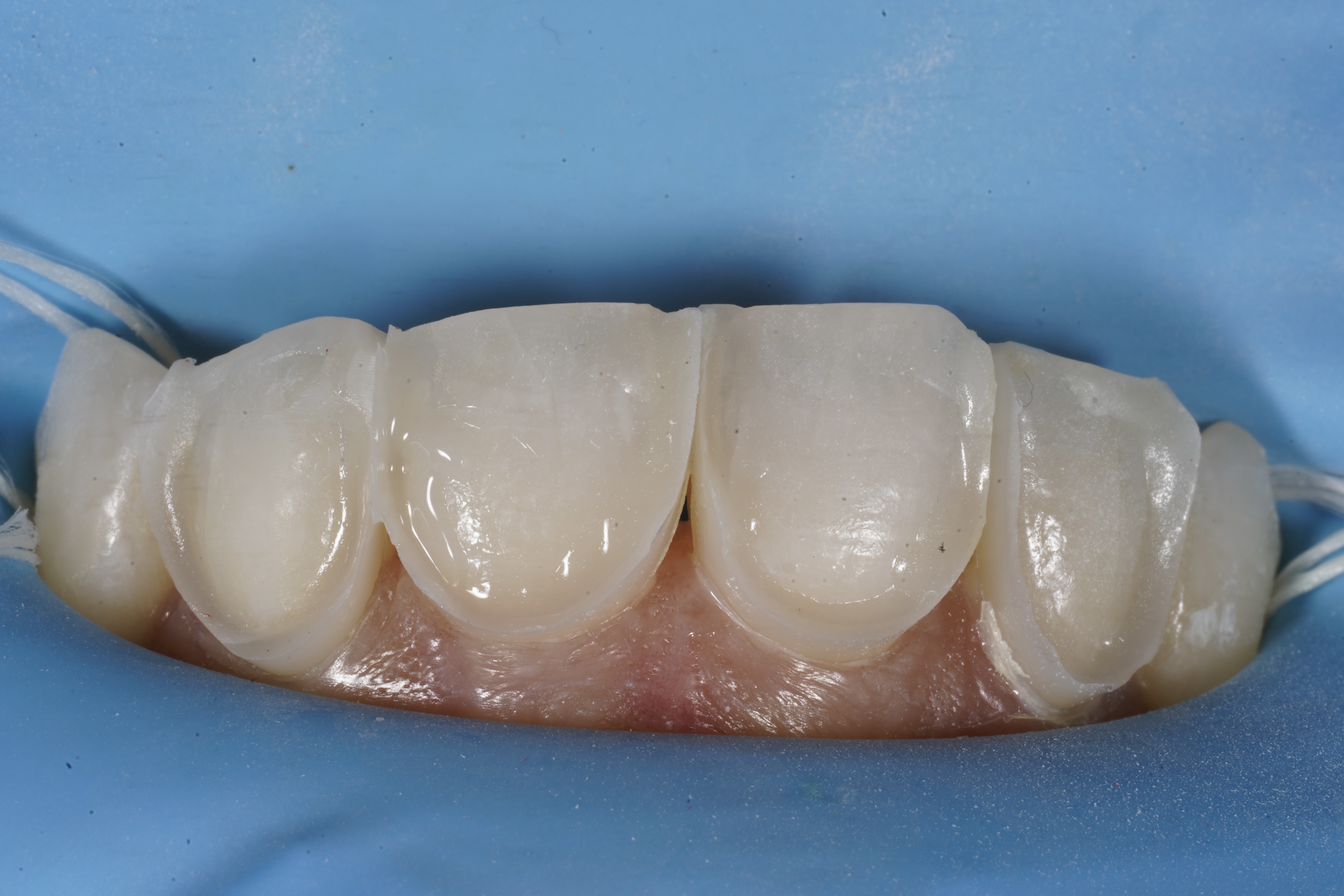 Composite bonding frame for even shapes and sizes