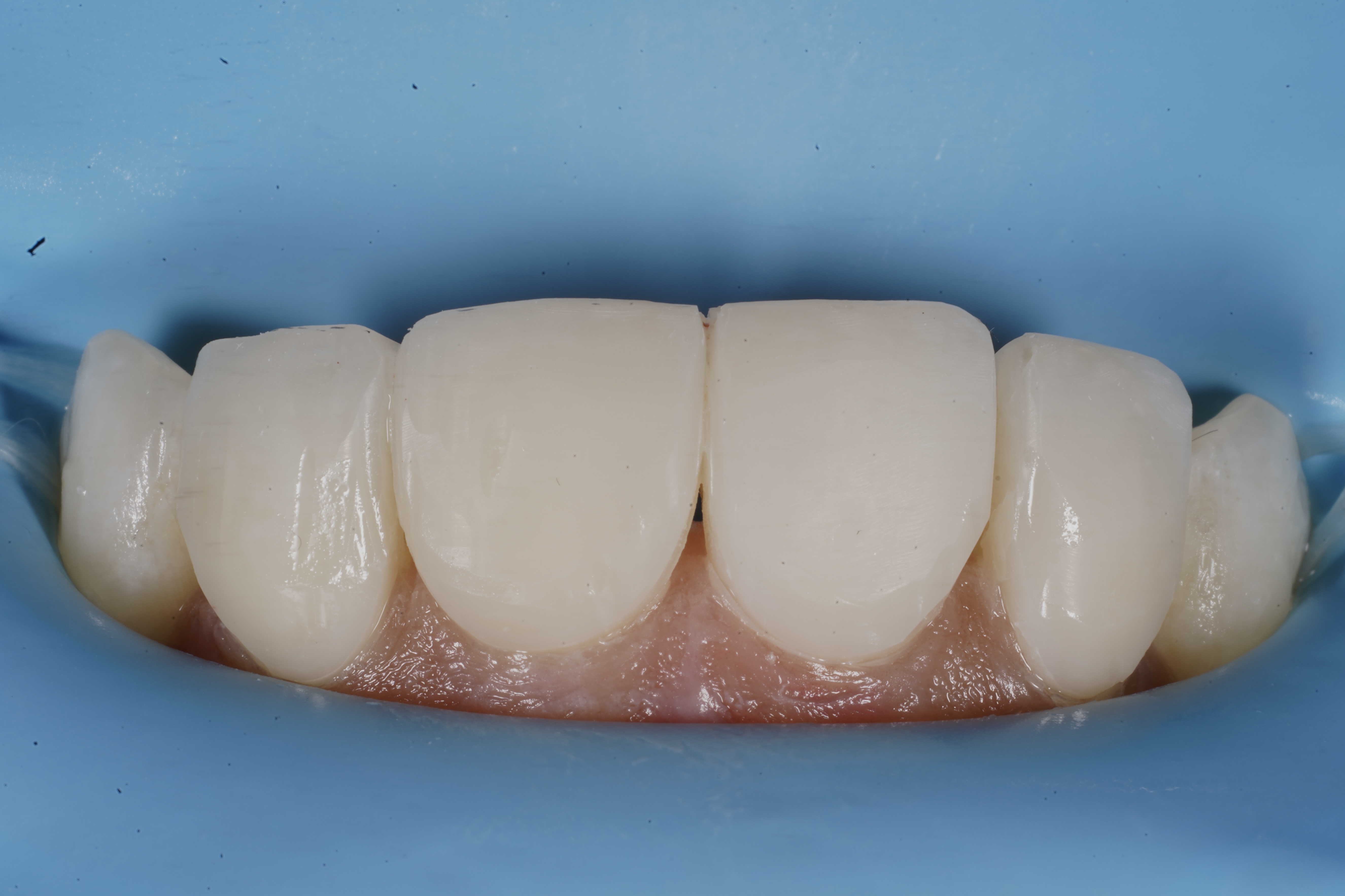 Composite bonding polishing after layering