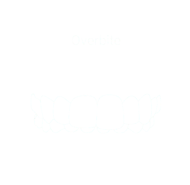 Overbite example