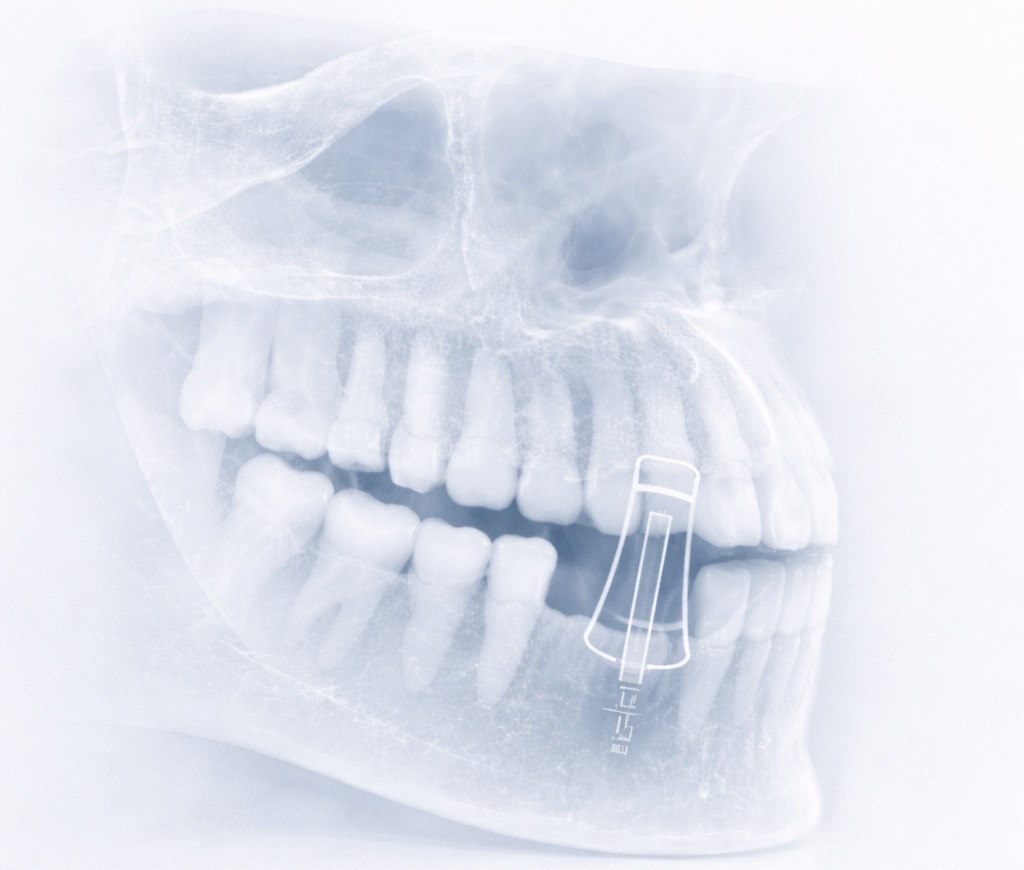 Assessment and planning stage